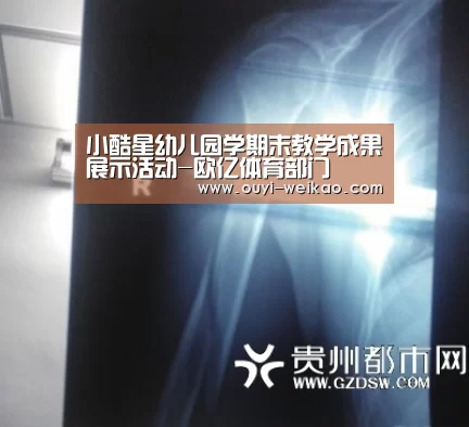 小酷星幼儿园学期末教学成果展示活动-欧亿体育部门(图3) 欧亿体育公司